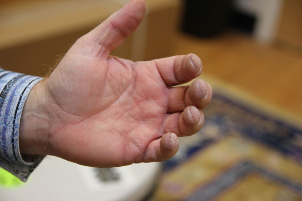 Couldn't resist posting this close up of David's fretting hand. Callouses like this don't lie. 